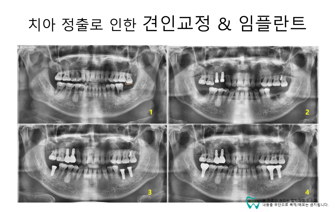 웰치과의원 성남 대표 이미지