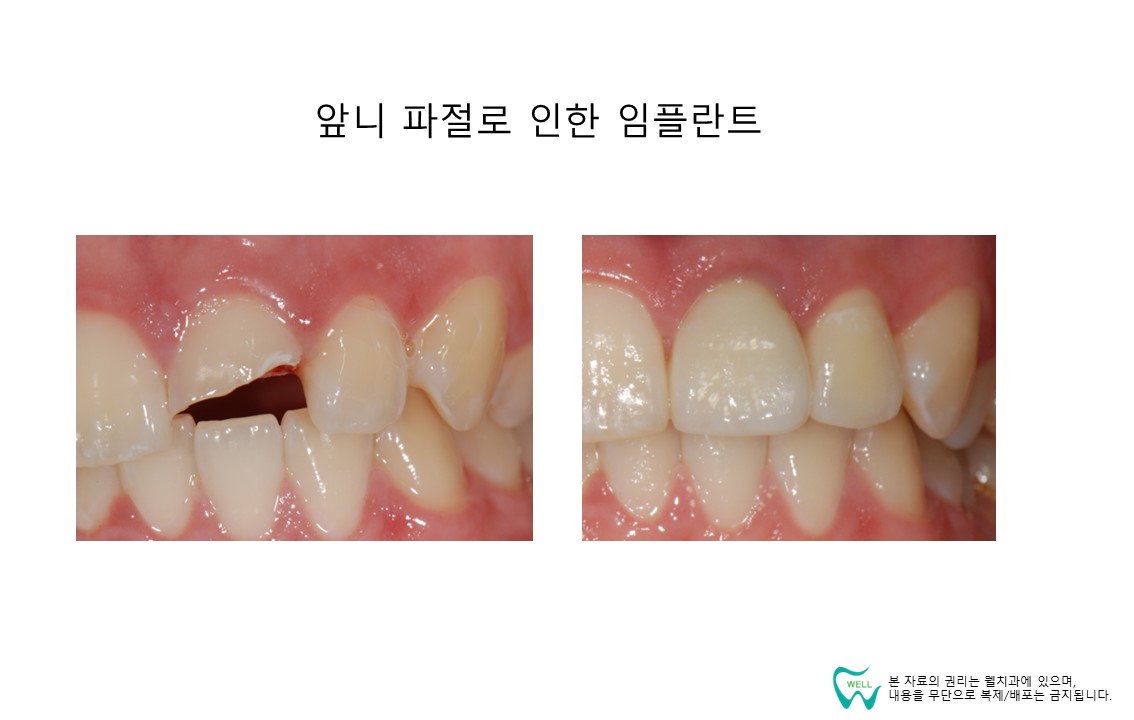 웰치과의원 성남 대표 이미지