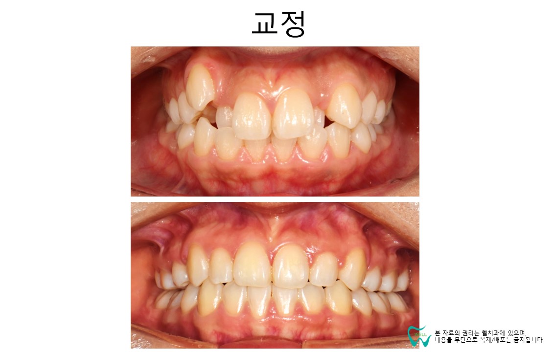 웰치과의원 성남 대표 이미지
