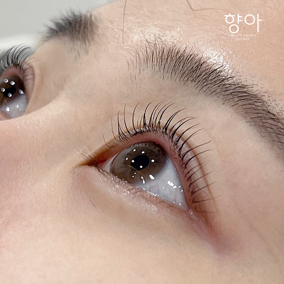 향아 대표 이미지