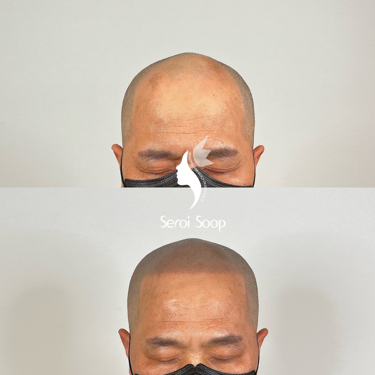 새로이숲 대표 이미지