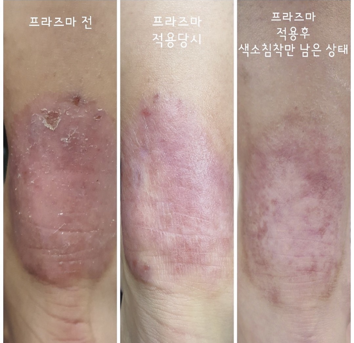 미라클뷰티랩 마곡본점
