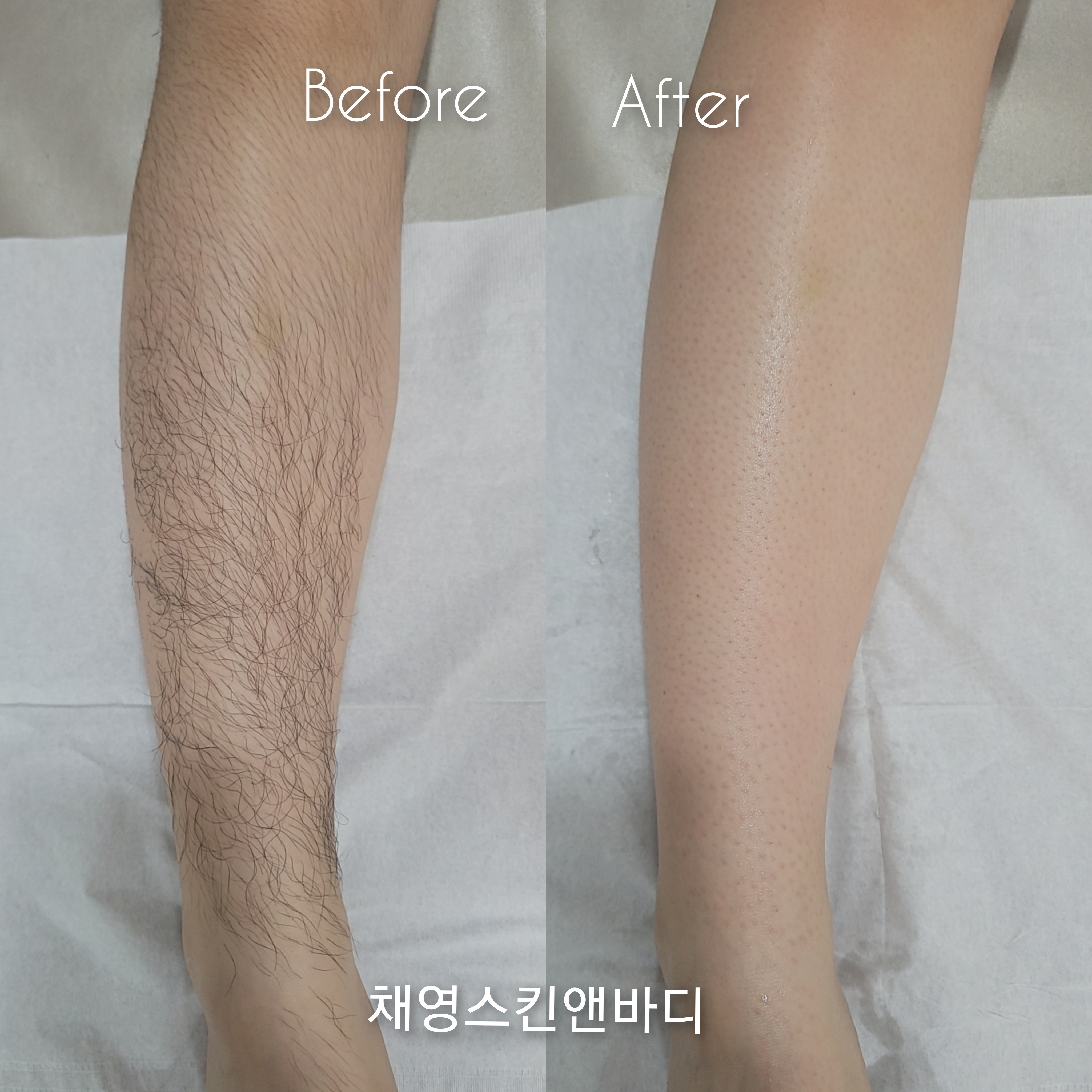채영 스킨앤바디 대표 이미지