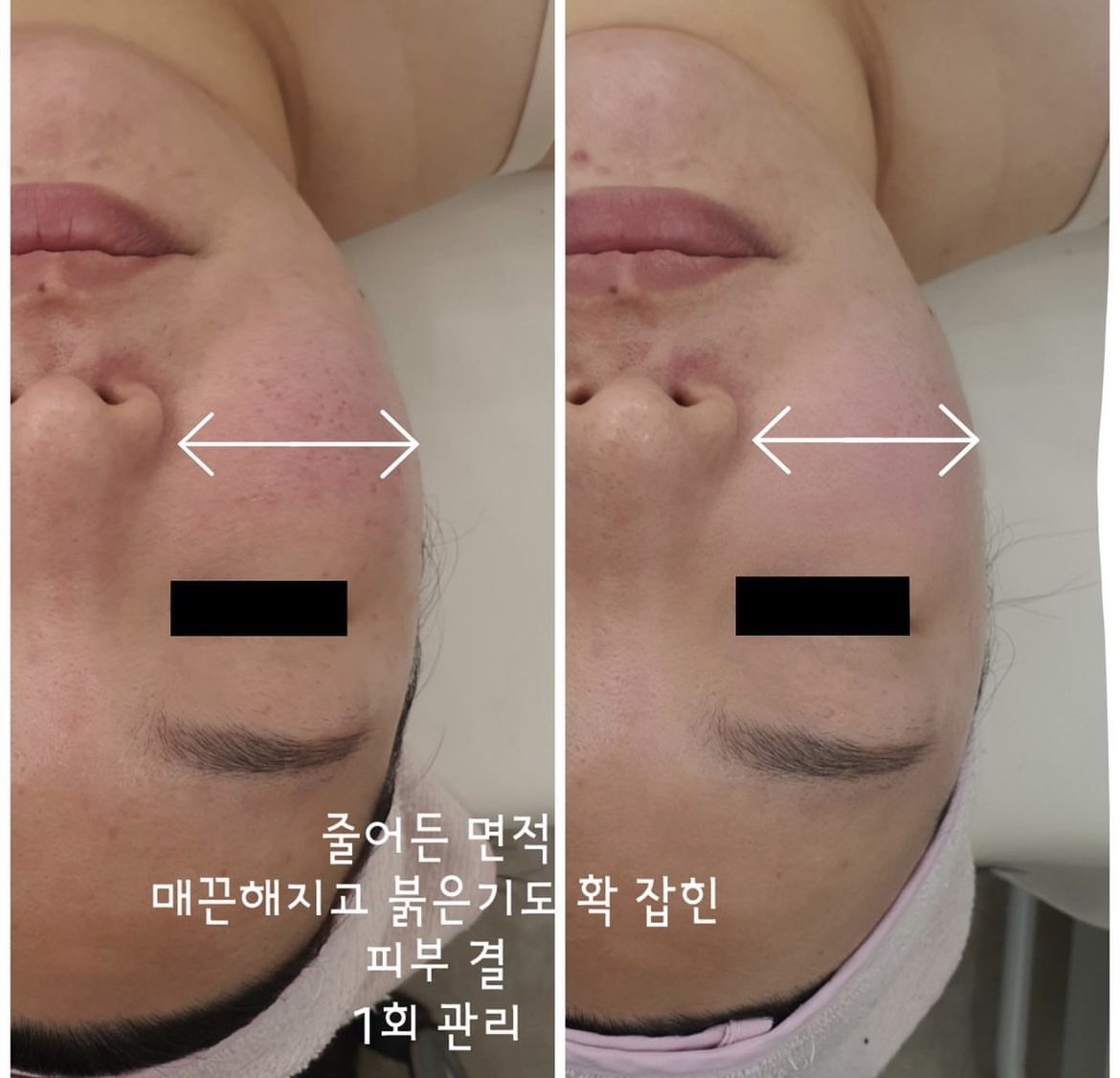 미라클뷰티랩 마곡본점