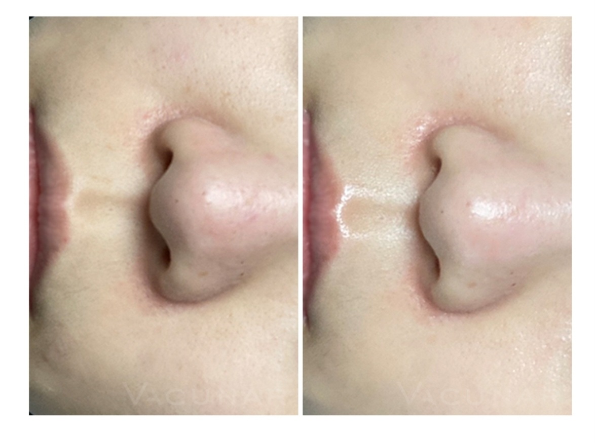 하임피부 대표 이미지