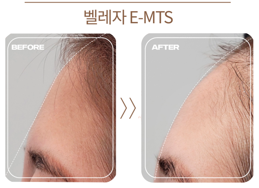 하임피부 대표 이미지