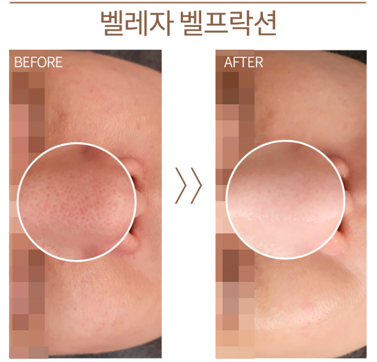 하임피부 대표 이미지