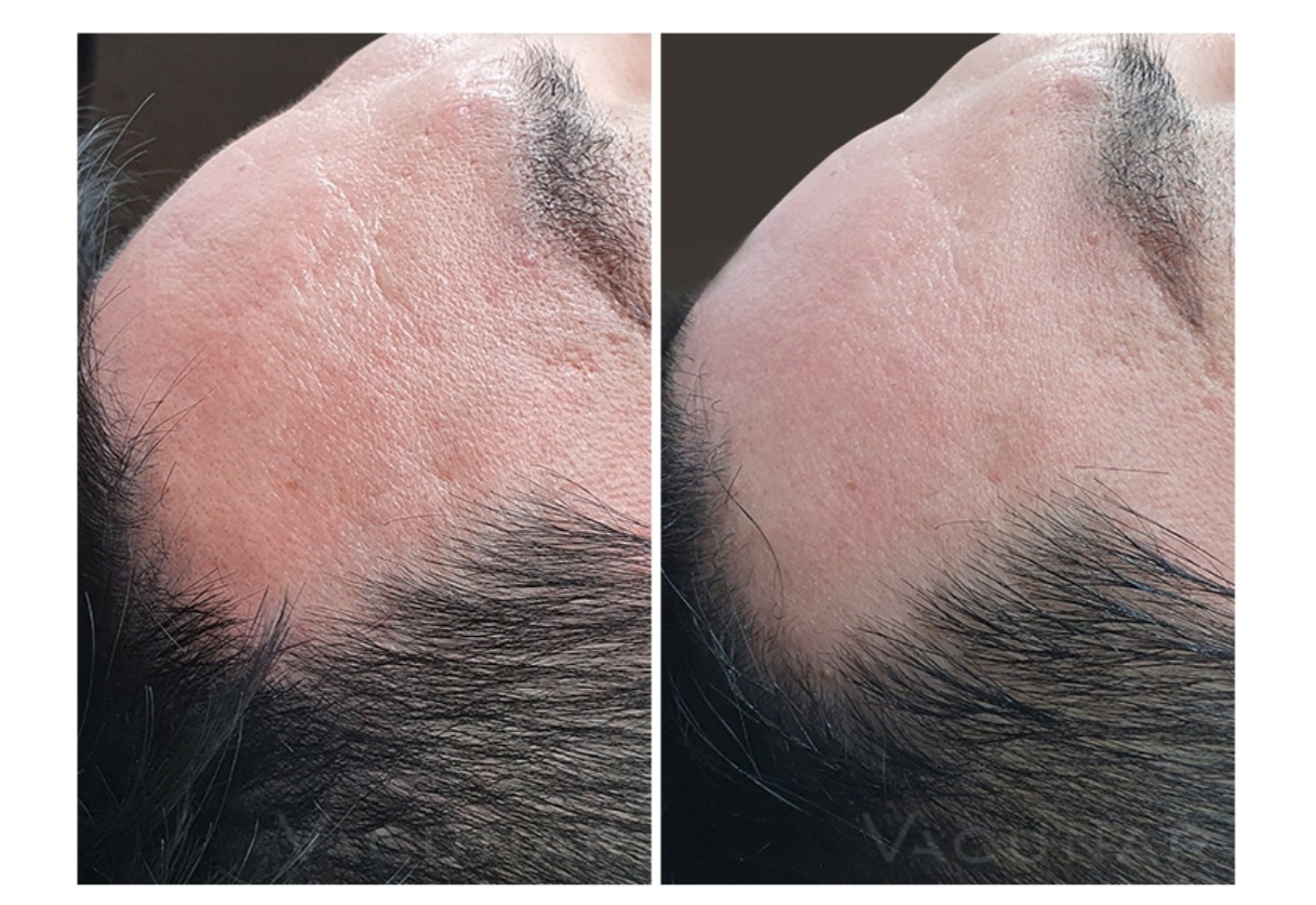 하임피부 대표 이미지