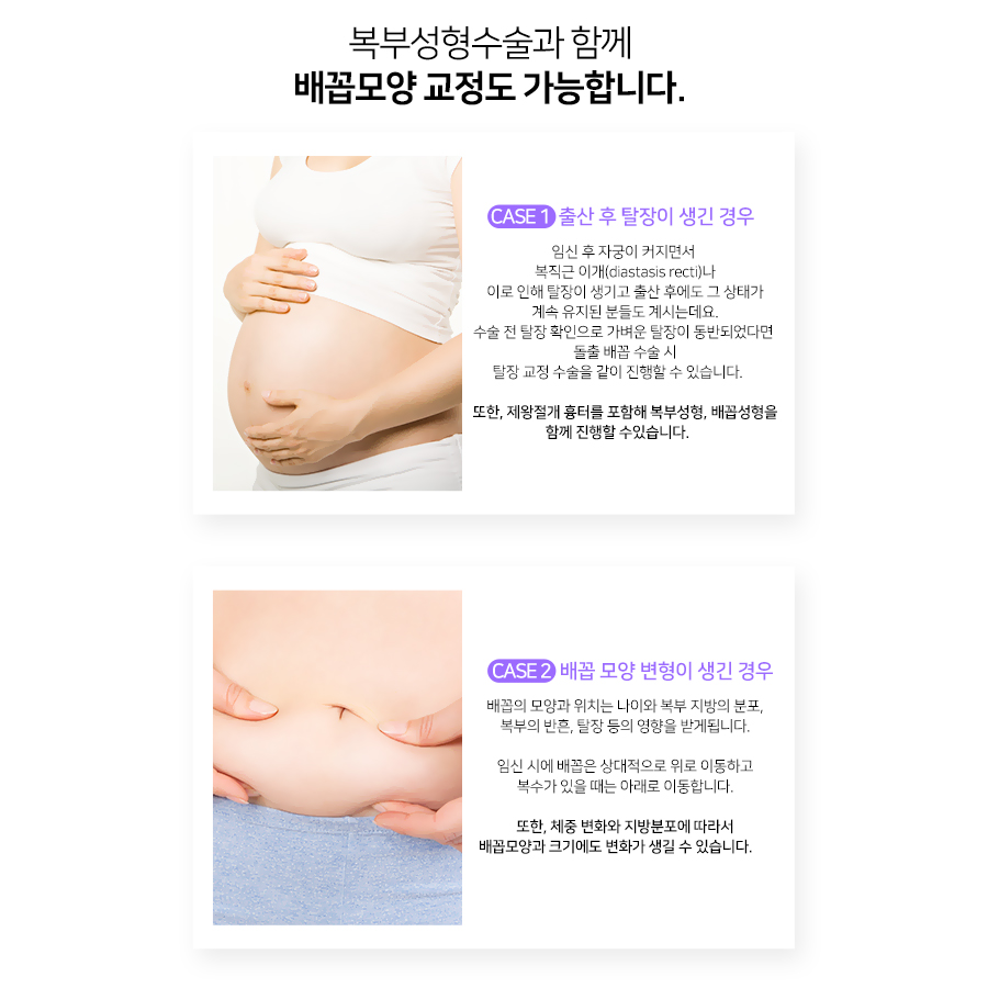 비에스티성형외과의원 대표 이미지