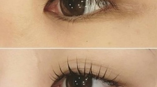에코에스테틱 대표 이미지