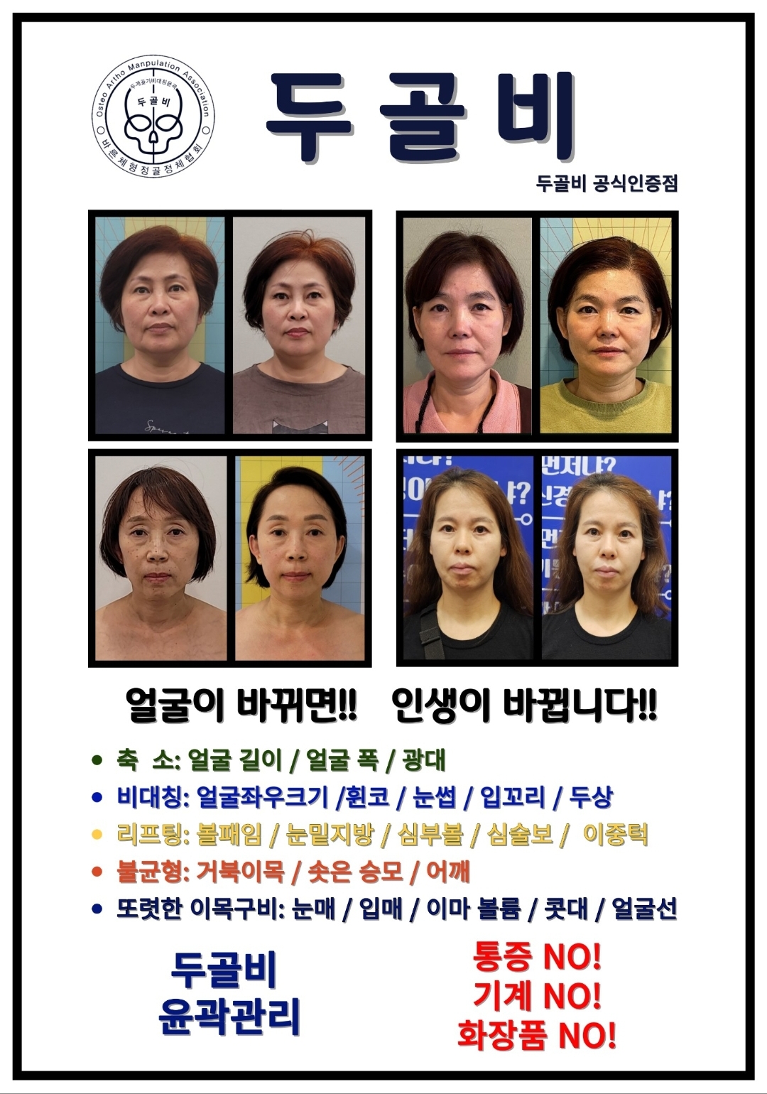 이아소에스떼