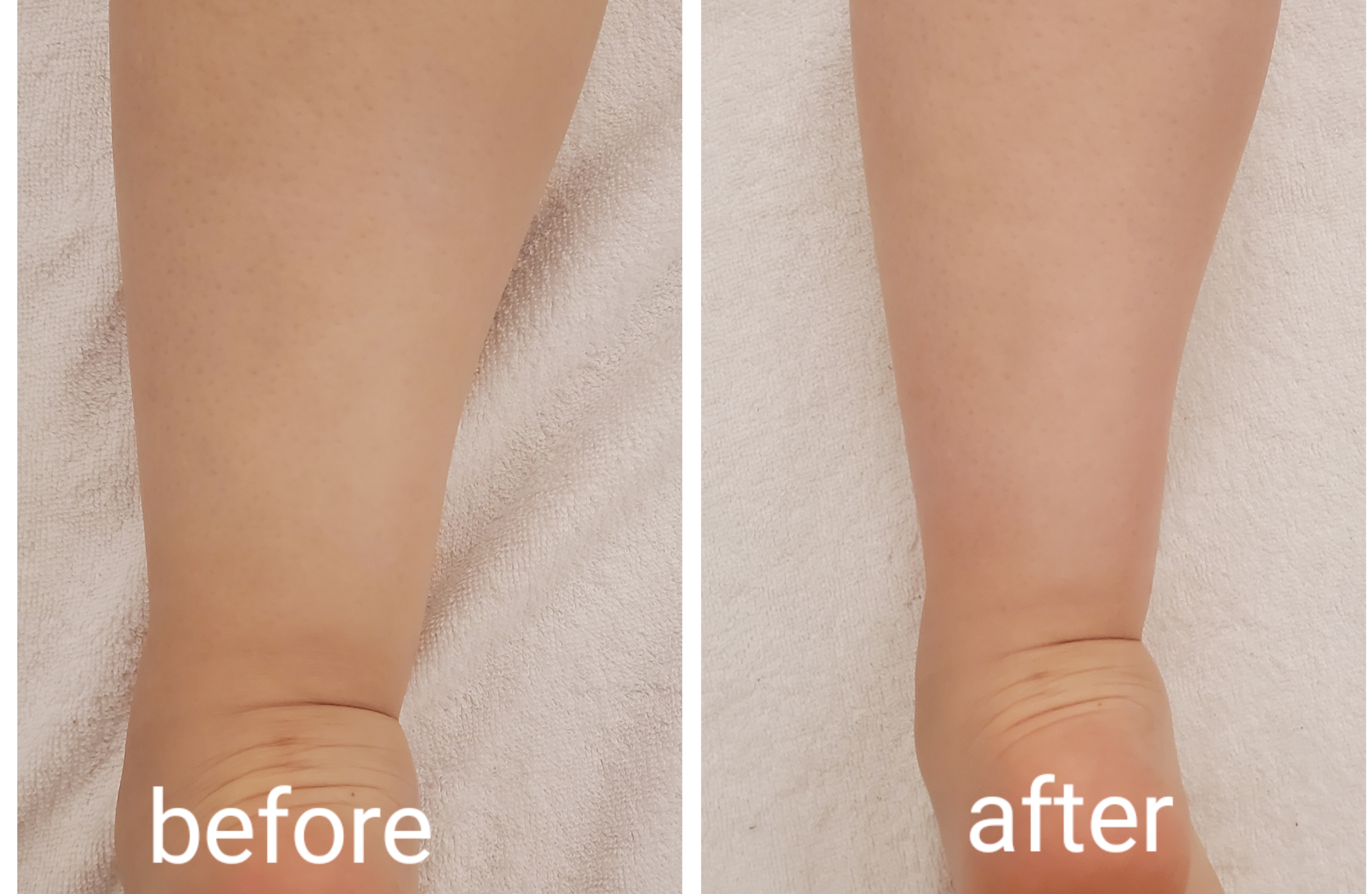 스킨라운지 대표 이미지