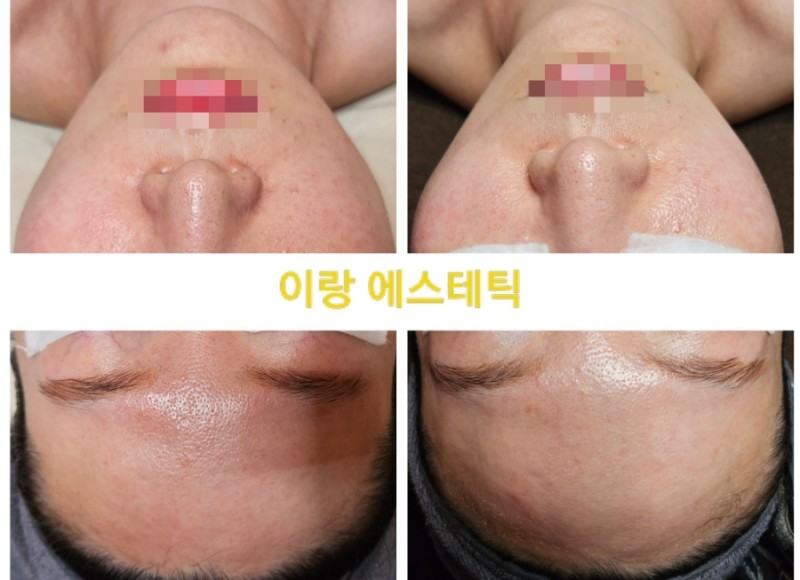 이랑에스테틱 미아본점 대표 이미지