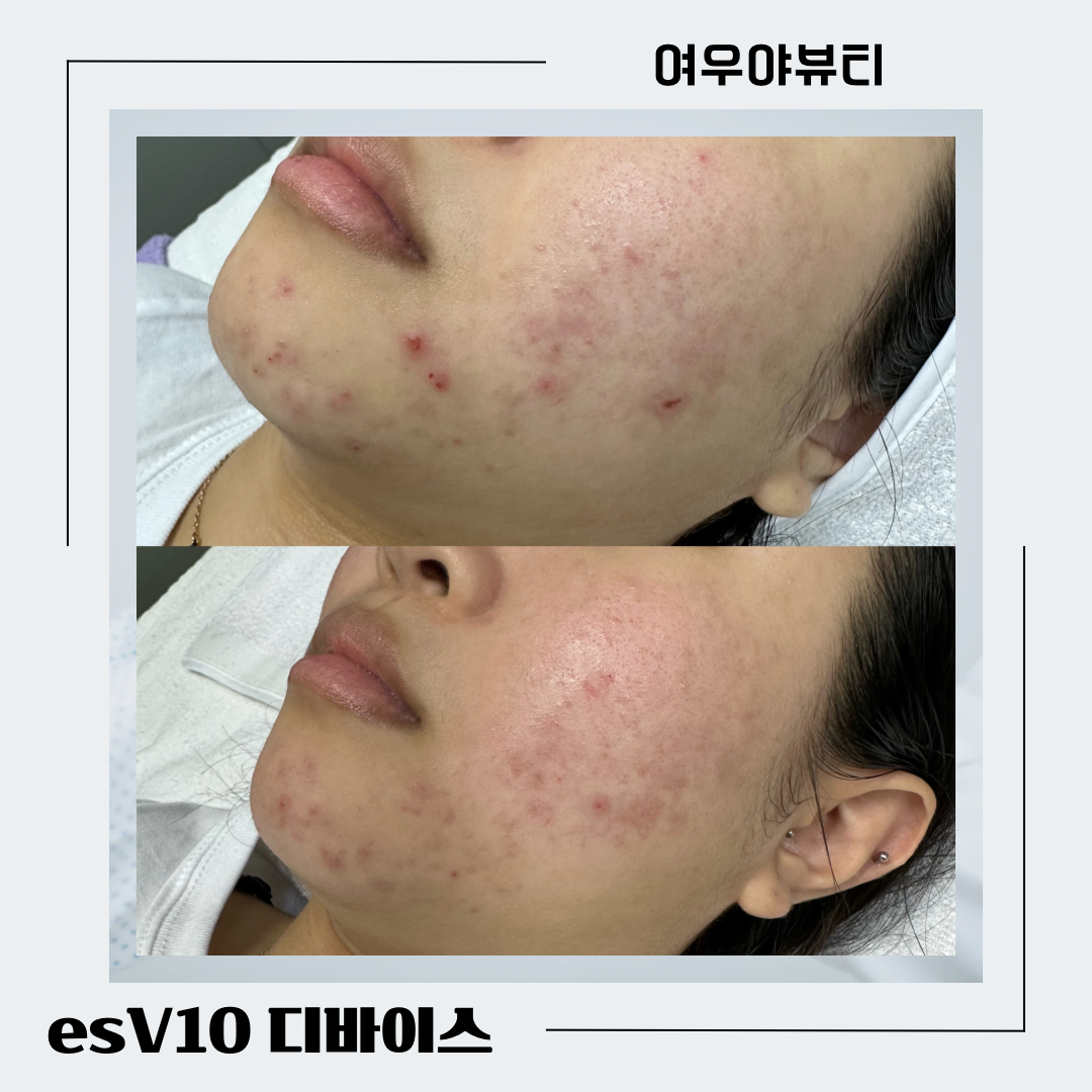 여우야 뷰티 원주점