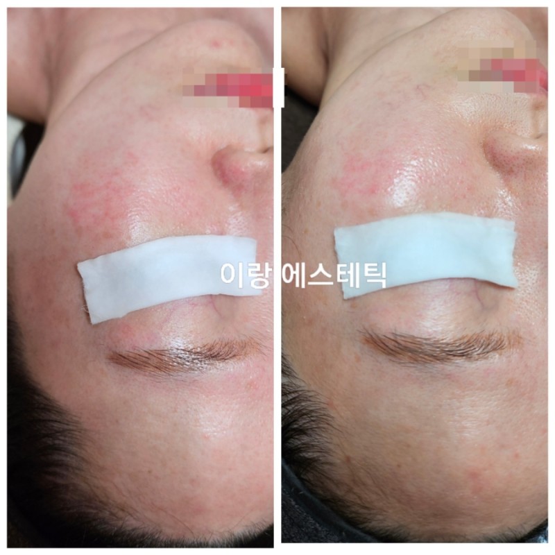 이랑에스테틱 미아본점 대표 이미지