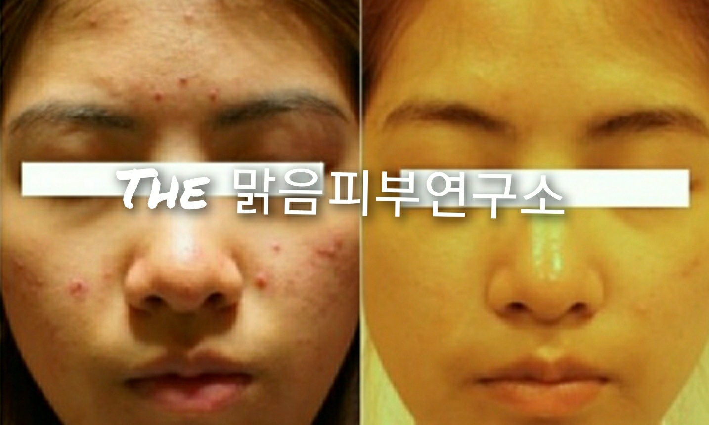 더맑음피부연구소 대표 이미지