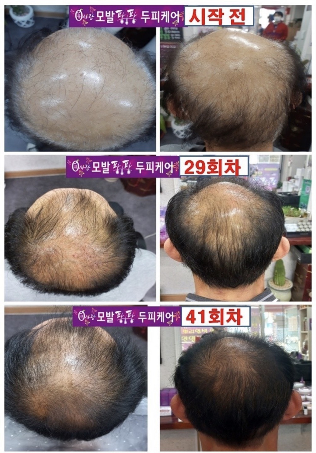 큐사랑 대표 이미지