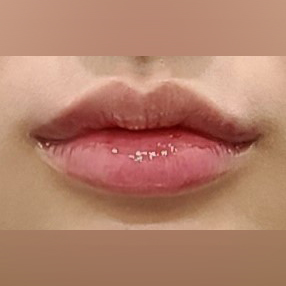 포인트업의원