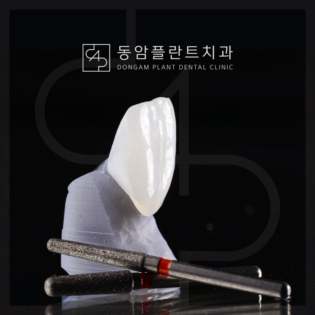 동암플란트치과의원 대표 이미지