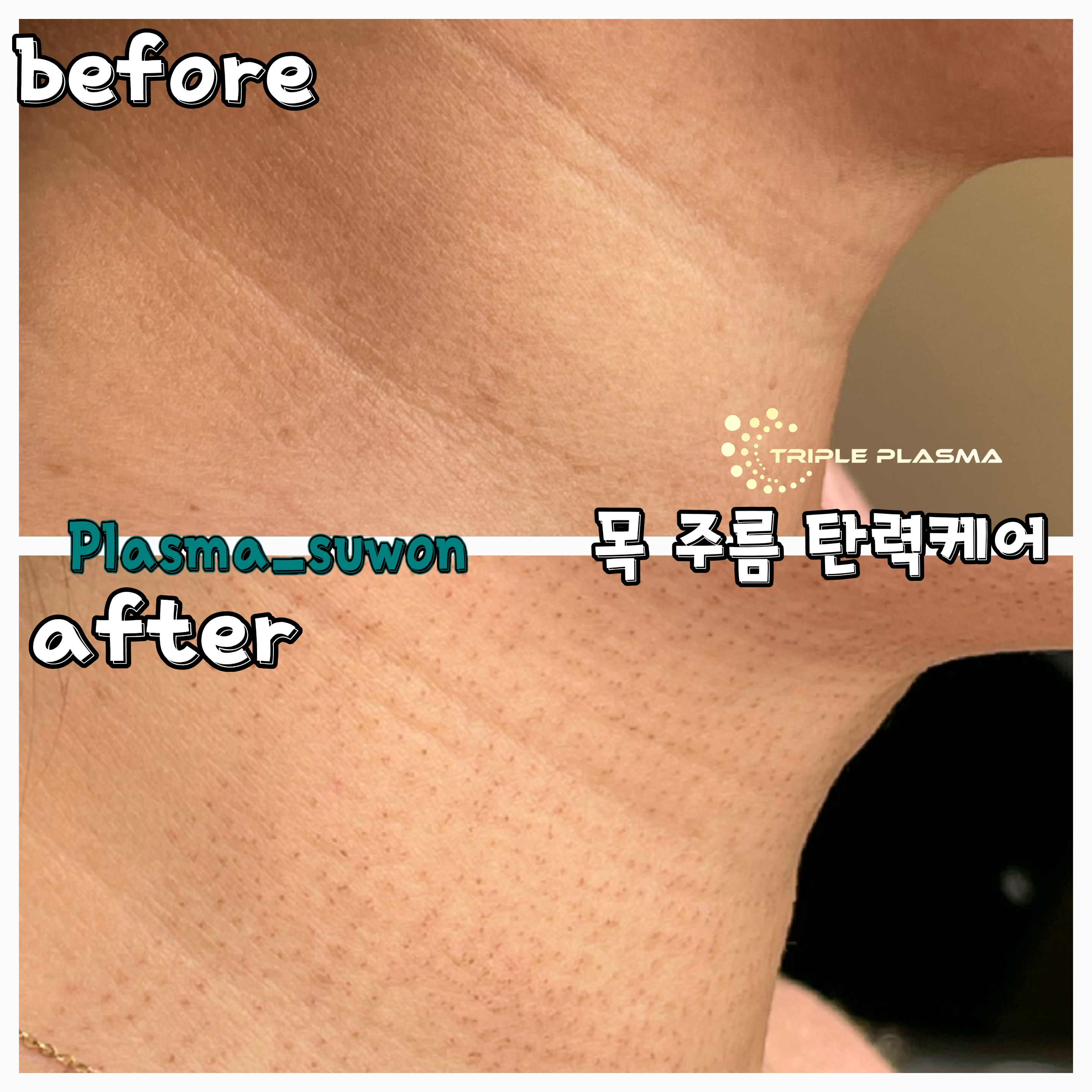 수원왁싱천사뷰티