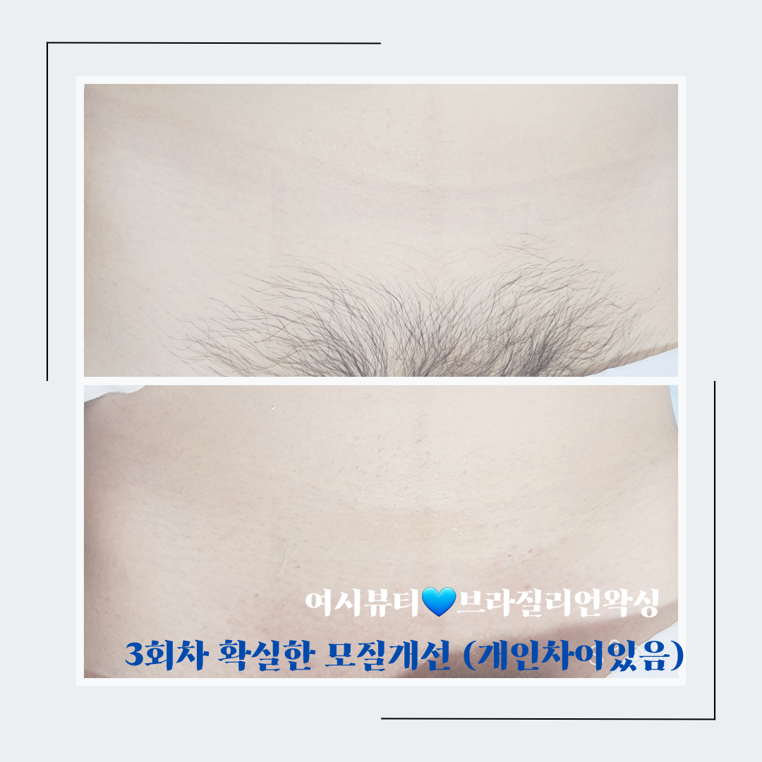 여시뷰티 왁싱&속눈썹