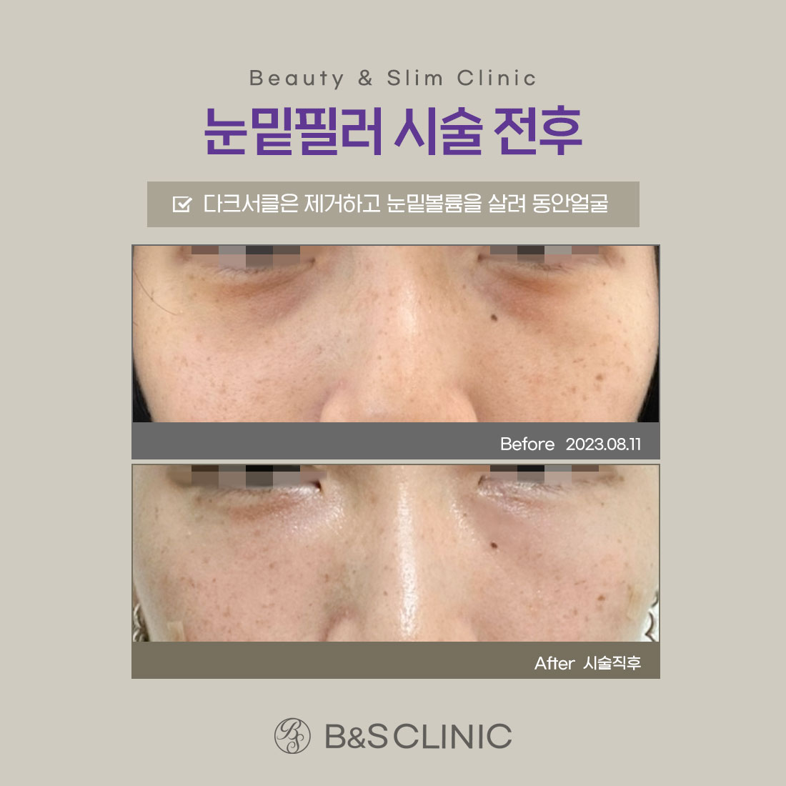 삼성비앤에스의원 강남 대표 이미지