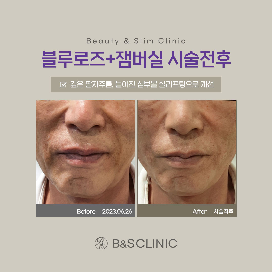 삼성비앤에스의원 강남 대표 이미지