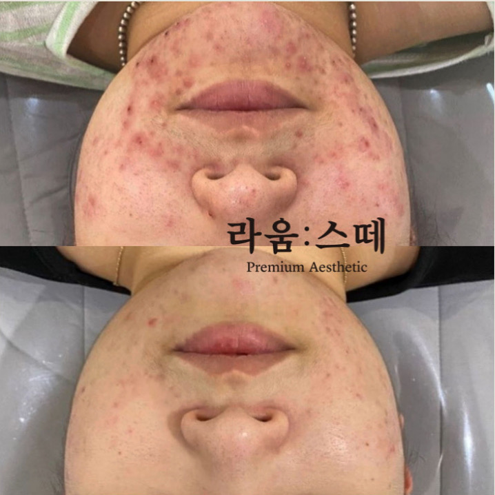 라움스떼 대표 이미지