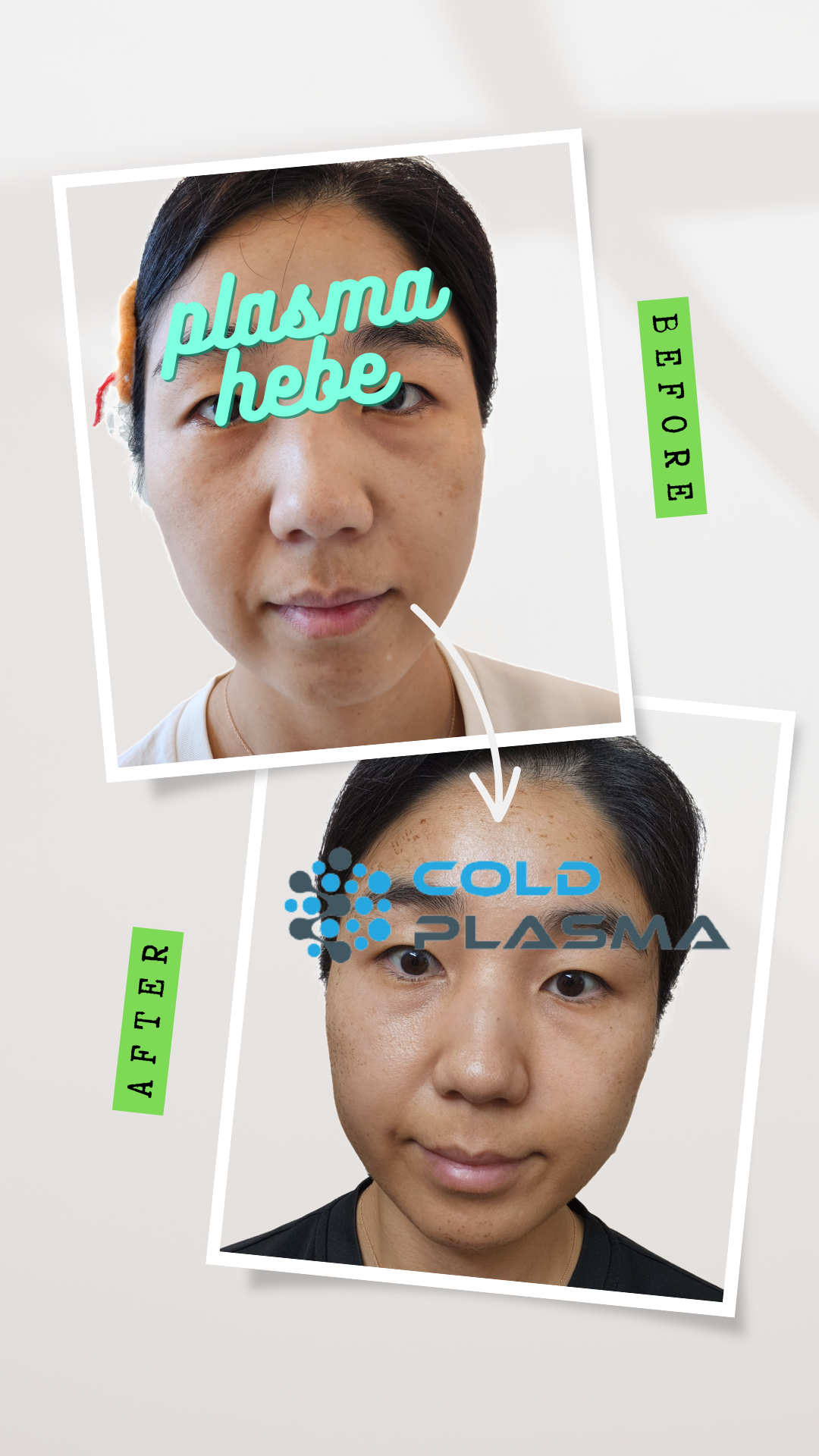 플라즈마헤베 울산본점