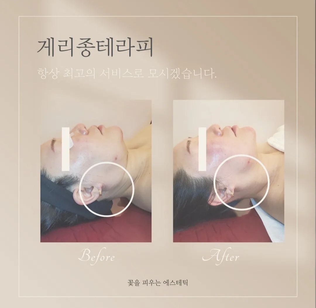 단미브로우