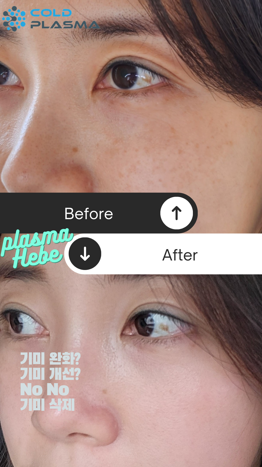 플라즈마헤베 울산본점