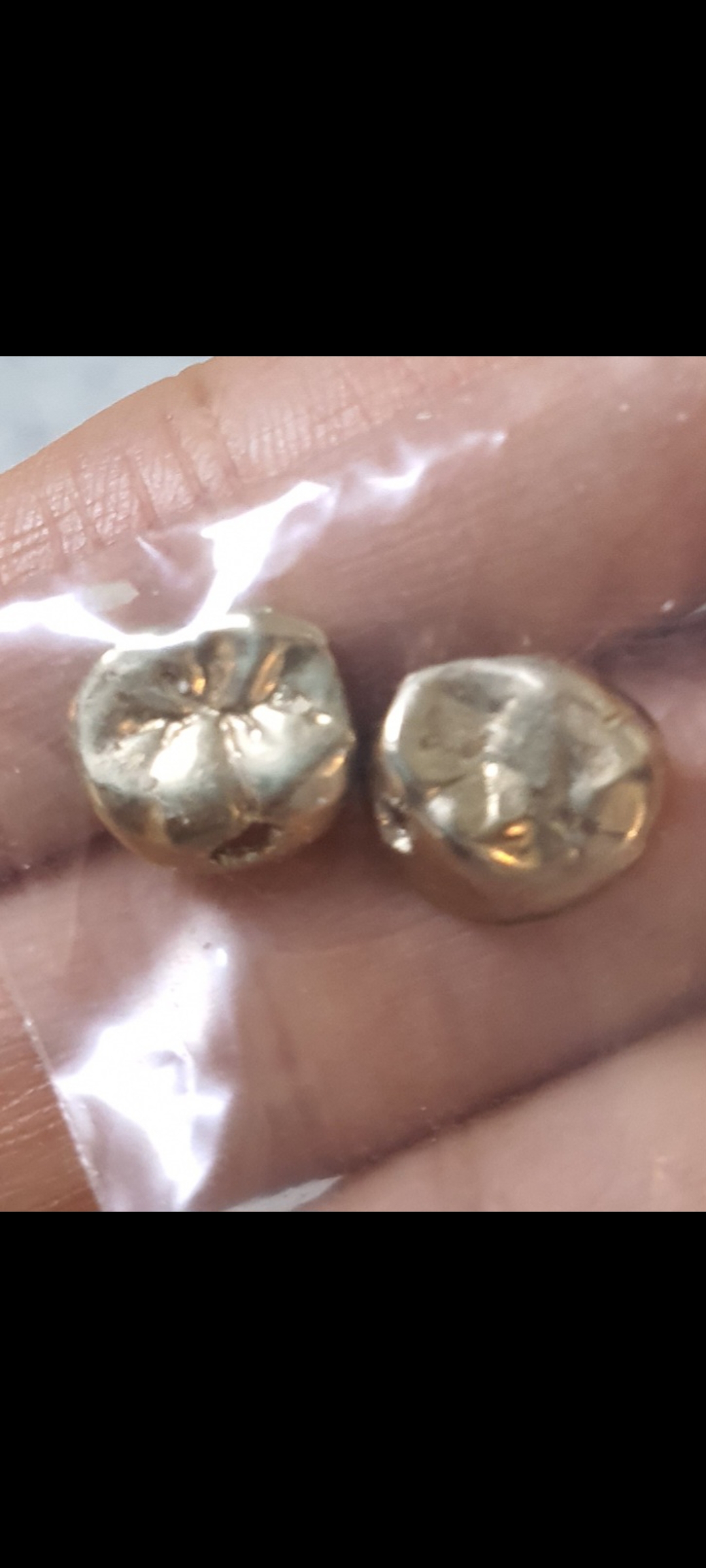 ๊ณจ๋์ธ ๊ธ๋๊ฑฐ๋์ ๋ํ ์ด๋ฏธ์ง