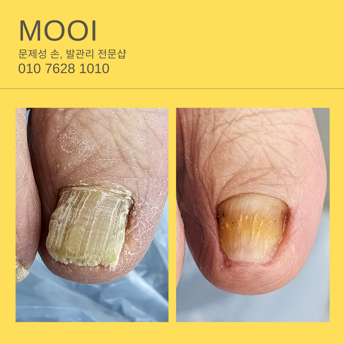 모이 대표 이미지