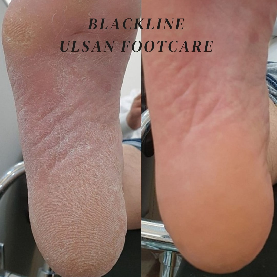 블랙라인 대표 이미지