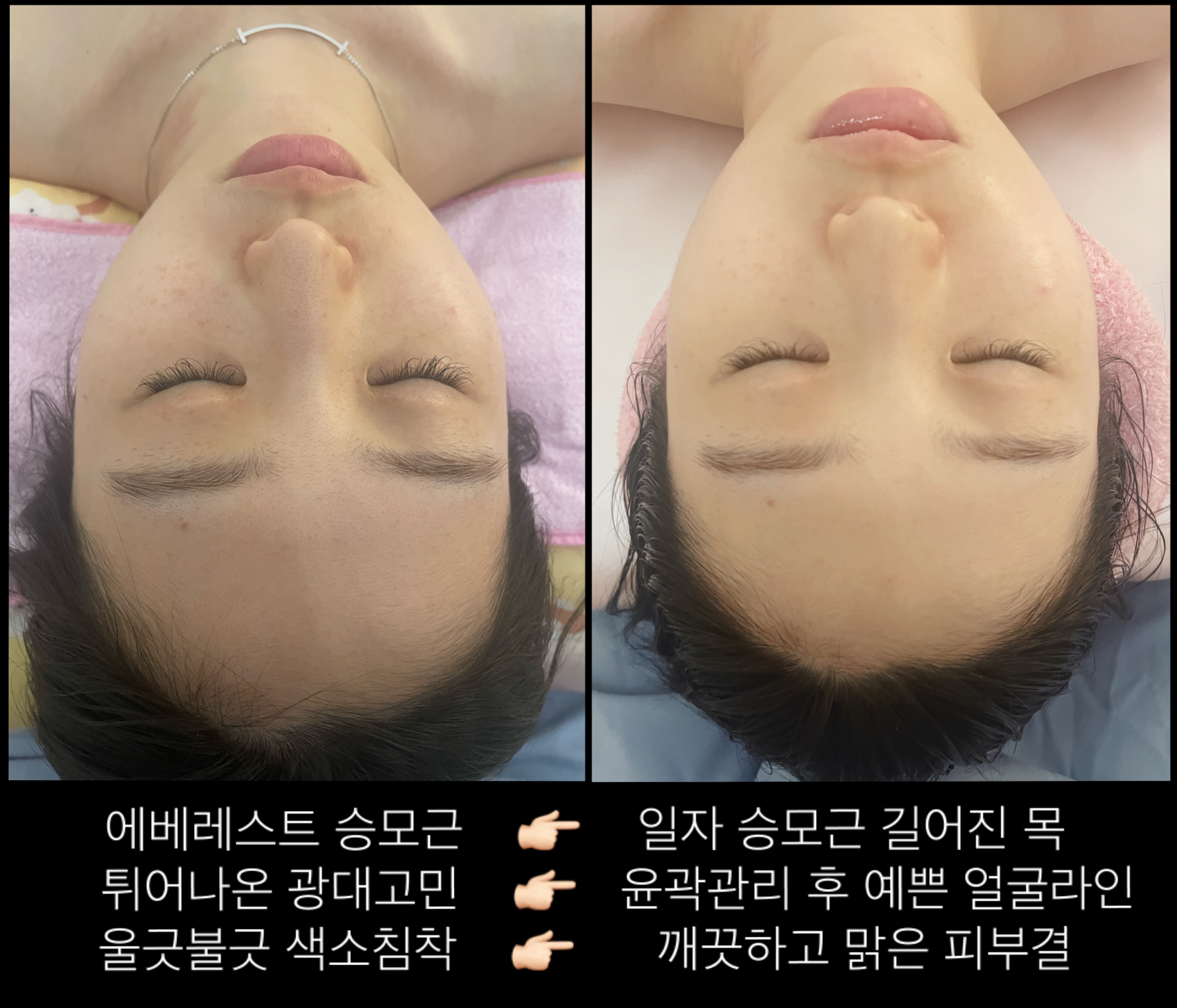 샐리뷰티스 에스테틱