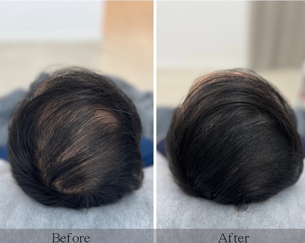 블랙라인 대표 이미지