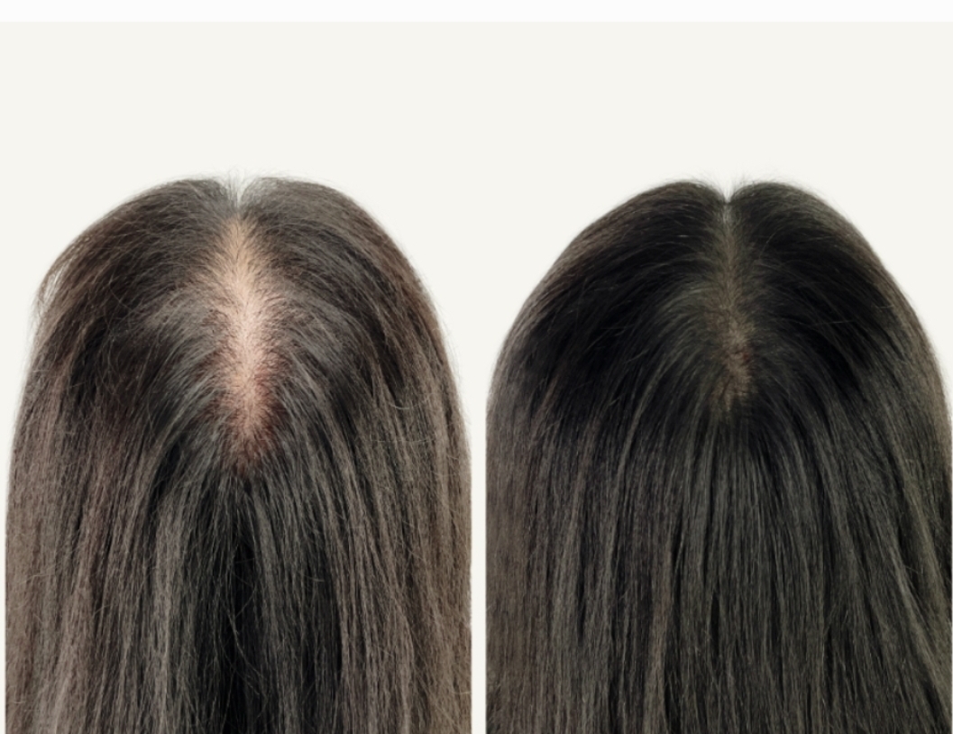 블랙라인 대표 이미지