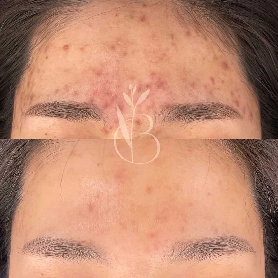 뷰티온리 의정부본점 대표 이미지