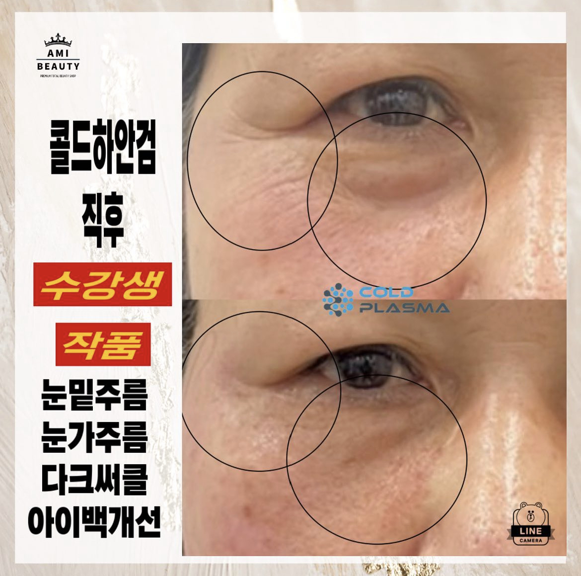 콜드플라즈마지사 아미뷰티 아카데미 대표 이미지