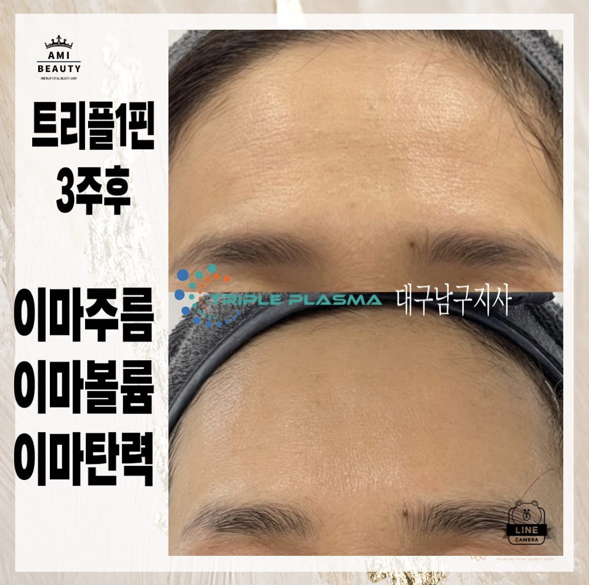 콜드플라즈마지사 아미뷰티 아카데미 대표 이미지