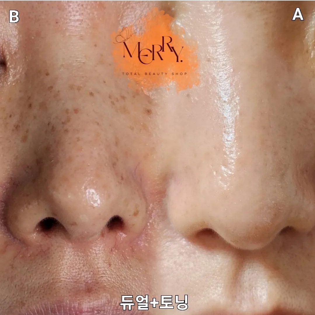 메리뷰티 대표 이미지