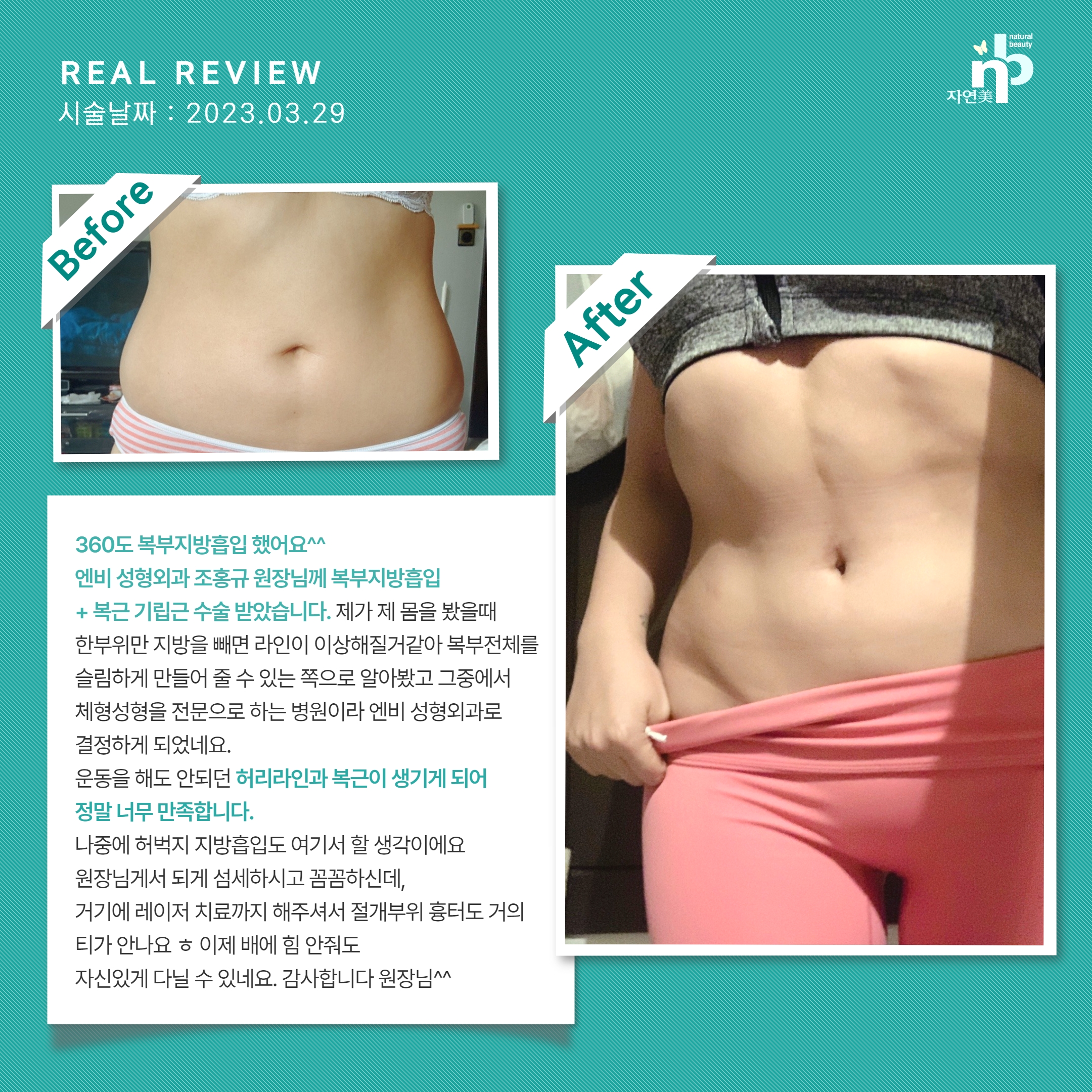 엔비성형외과 대표 이미지