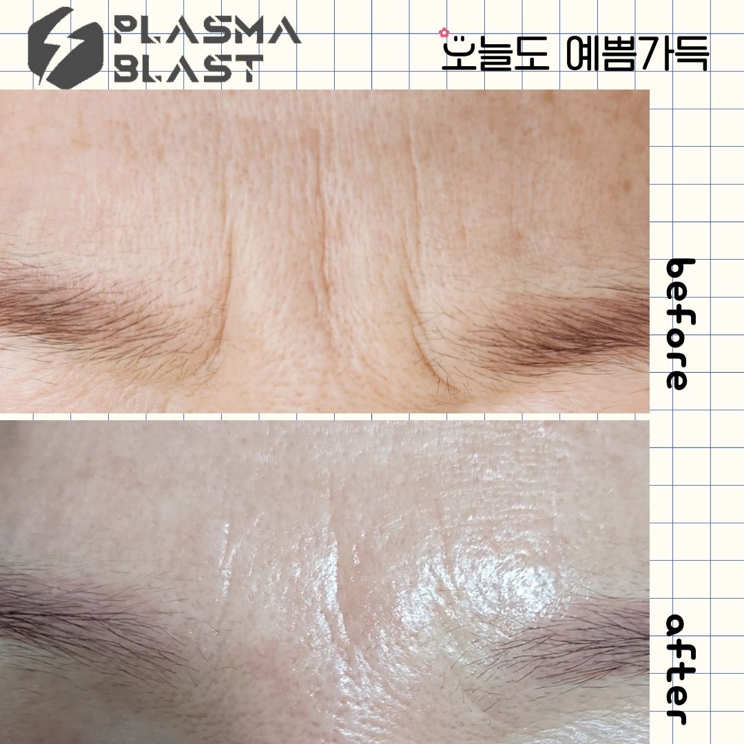 오늘도예쁨가득