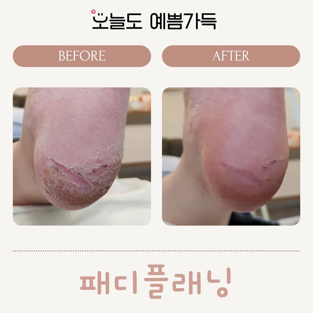 오늘도예쁨가득