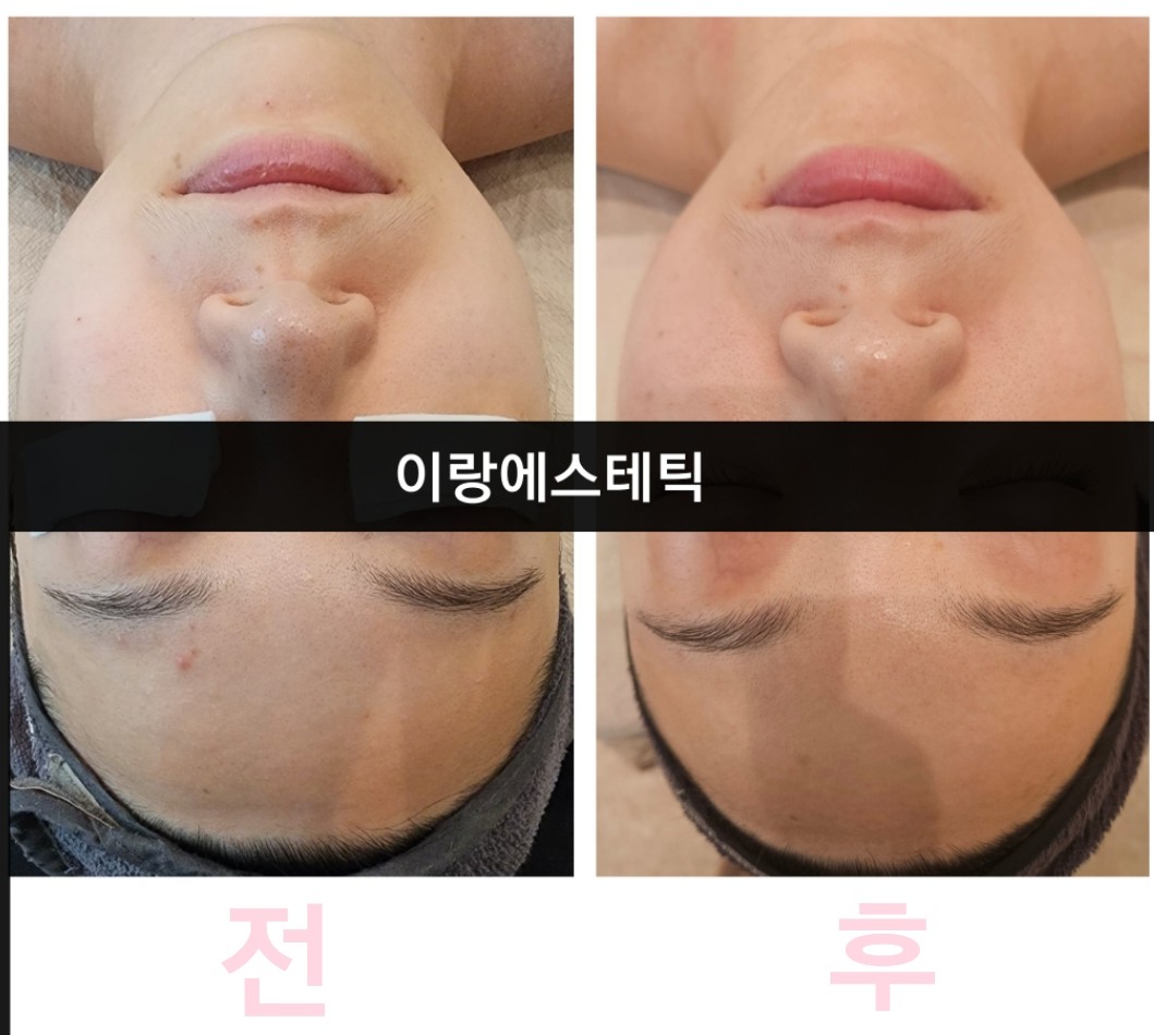 이랑에스테틱 대표 이미지