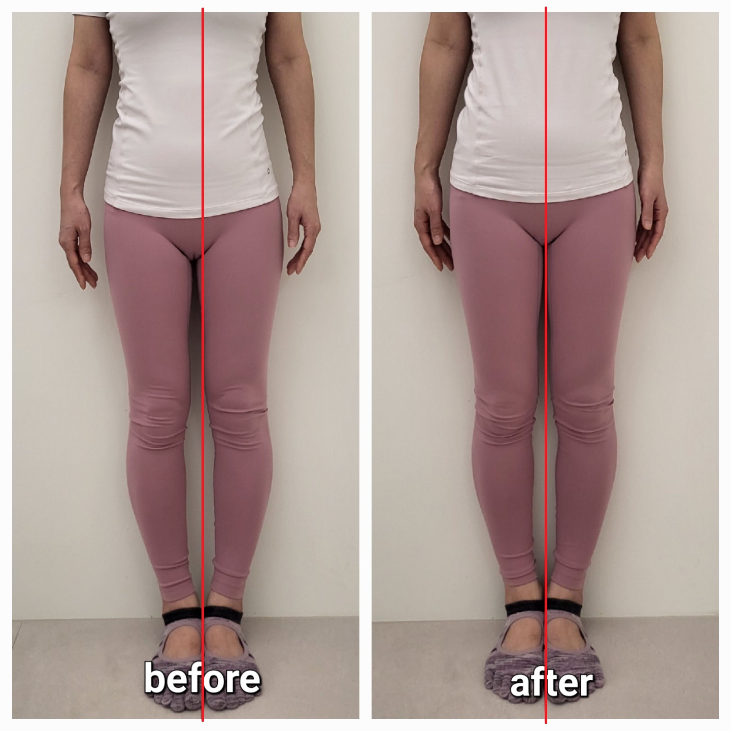 바름다움 필라테스 홍대점 대표 이미지