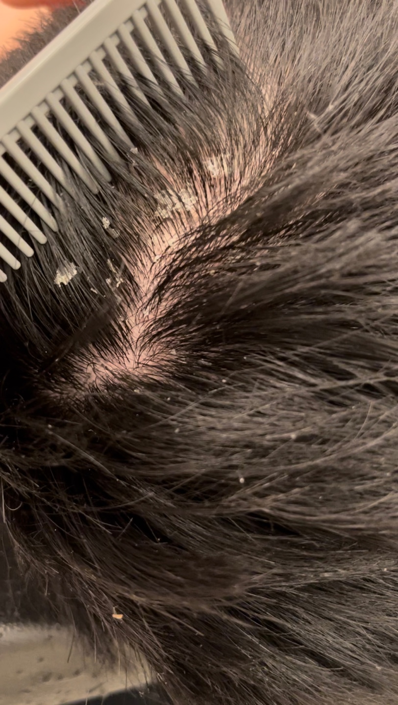 칠월림 헤드스파 대표 이미지