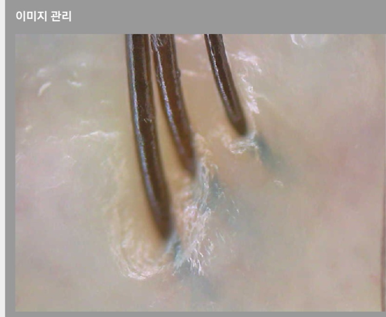 감탄헤드스파두피클리닉 대표 이미지