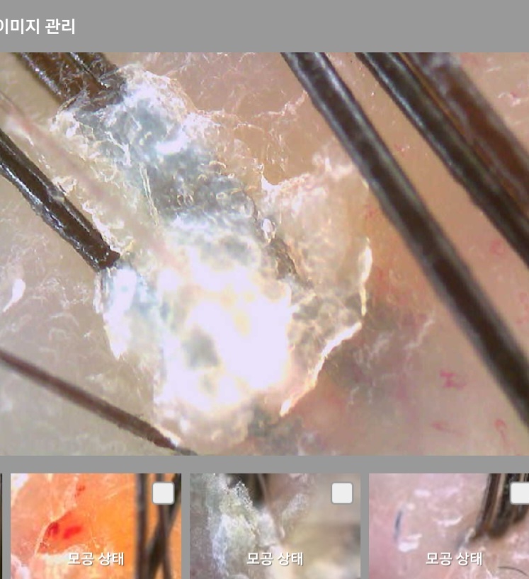 감탄헤드스파두피클리닉 대표 이미지