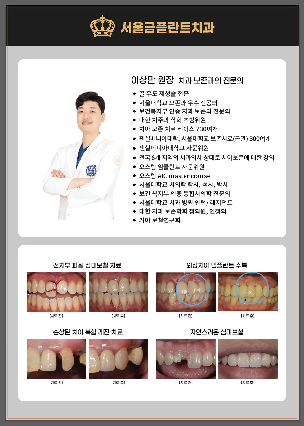 서울금플란트치과의원 은평